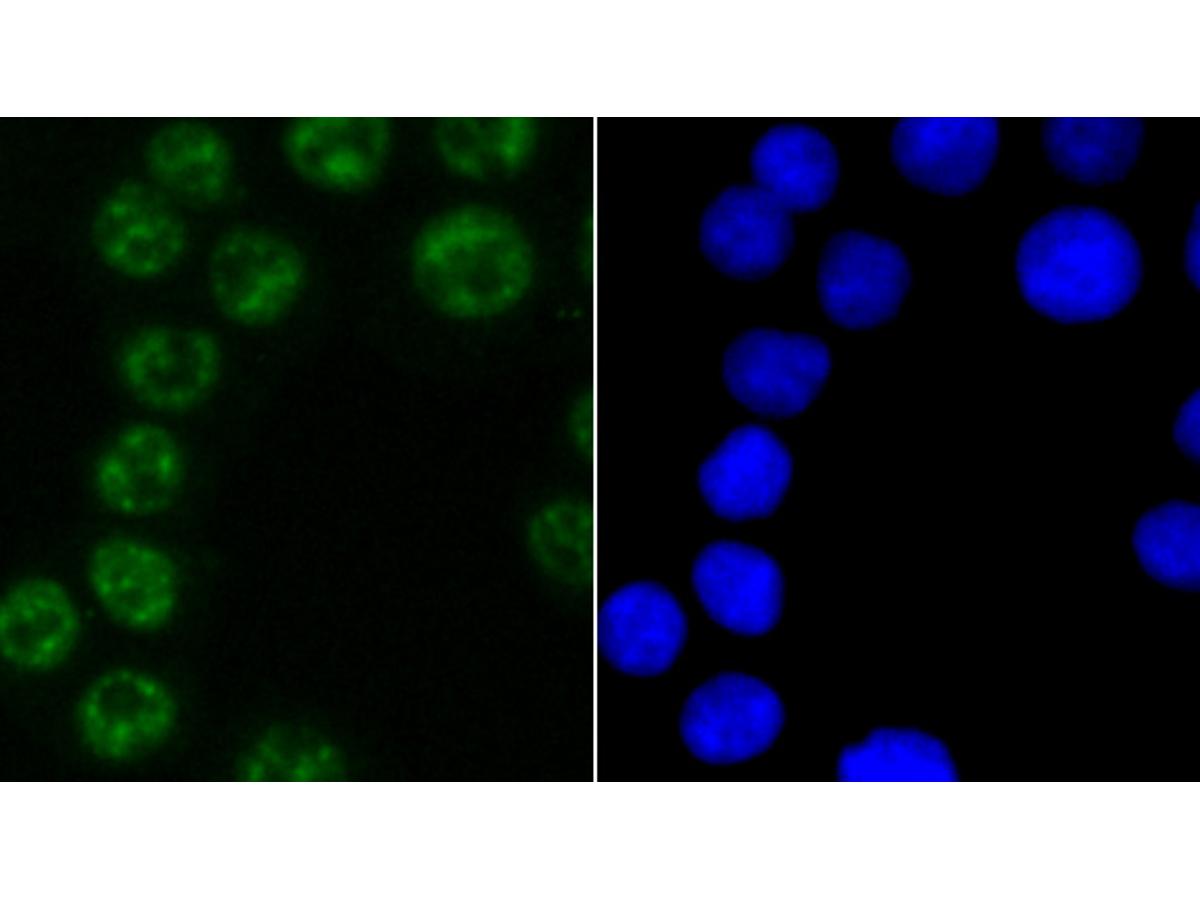 ICC staining of PABPN1 in SW480 cells (green). Formalin fixed cells were permeabilized with 0.1% Triton X-100 in TBS for 10 minutes at room temperature and blocked with 1% Blocker BSA for 15 minutes at room temperature. Cells were probed with the primary antibody (ET1703-66, 1/50) for 1 hour at room temperature, washed with PBS. Alexa Fluor®488 Goat anti-Rabbit IgG was used as the secondary antibody at 1/1,000 dilution. The nuclear counter stain is DAPI (blue).