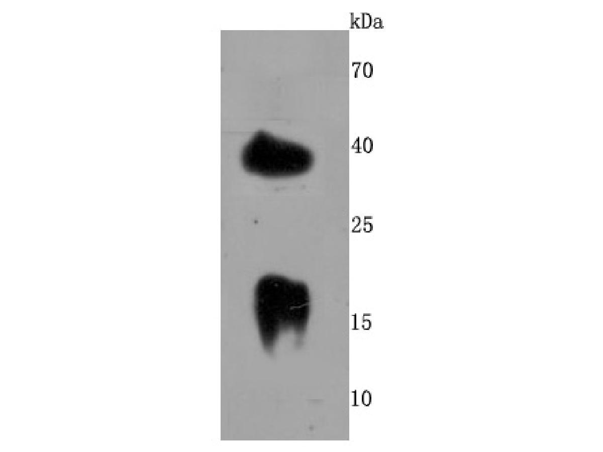 Western blot analysis of LY6A on mouse brain cells lysates using anti-LY6A antibody at 1/500 dilution.