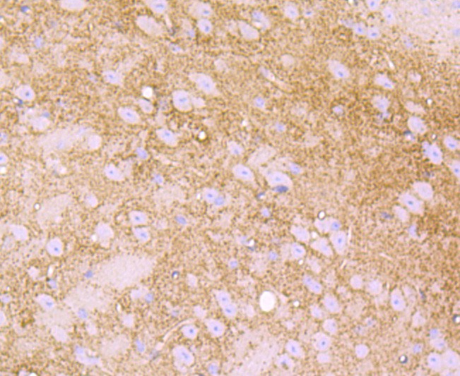 Immunohistochemical analysis of paraffin-embedded mouse brain tissue using anti-LY6A antibody. Counter stained with hematoxylin.