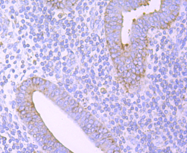 Immunohistochemical analysis of paraffin-embedded human uterus tissue using anti-ERp57 antibody. Counter stained with hematoxylin.