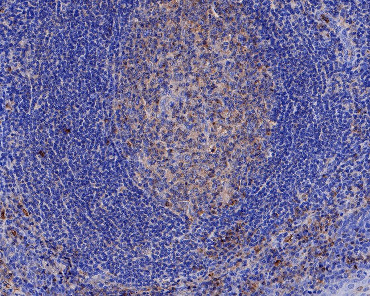 Immunohistochemical analysis of paraffin-embedded human tonsil tissue tissue with Rabbit anti-A2M antibody (ET1703-69) at 1/50 dilution.<br />
<br />
The section was pre-treated using heat mediated antigen retrieval with Tris-EDTA buffer (pH 9.0) for 20 minutes. The tissues were blocked in 1% BSA for 20 minutes at room temperature, washed with ddH2O and PBS, and then probed with the primary antibody (ET1703-69) at 1/50 dilution for 1 hour at room temperature. The detection was performed using an HRP conjugated compact polymer system. DAB was used as the chromogen. Tissues were counterstained with hematoxylin and mounted with DPX.