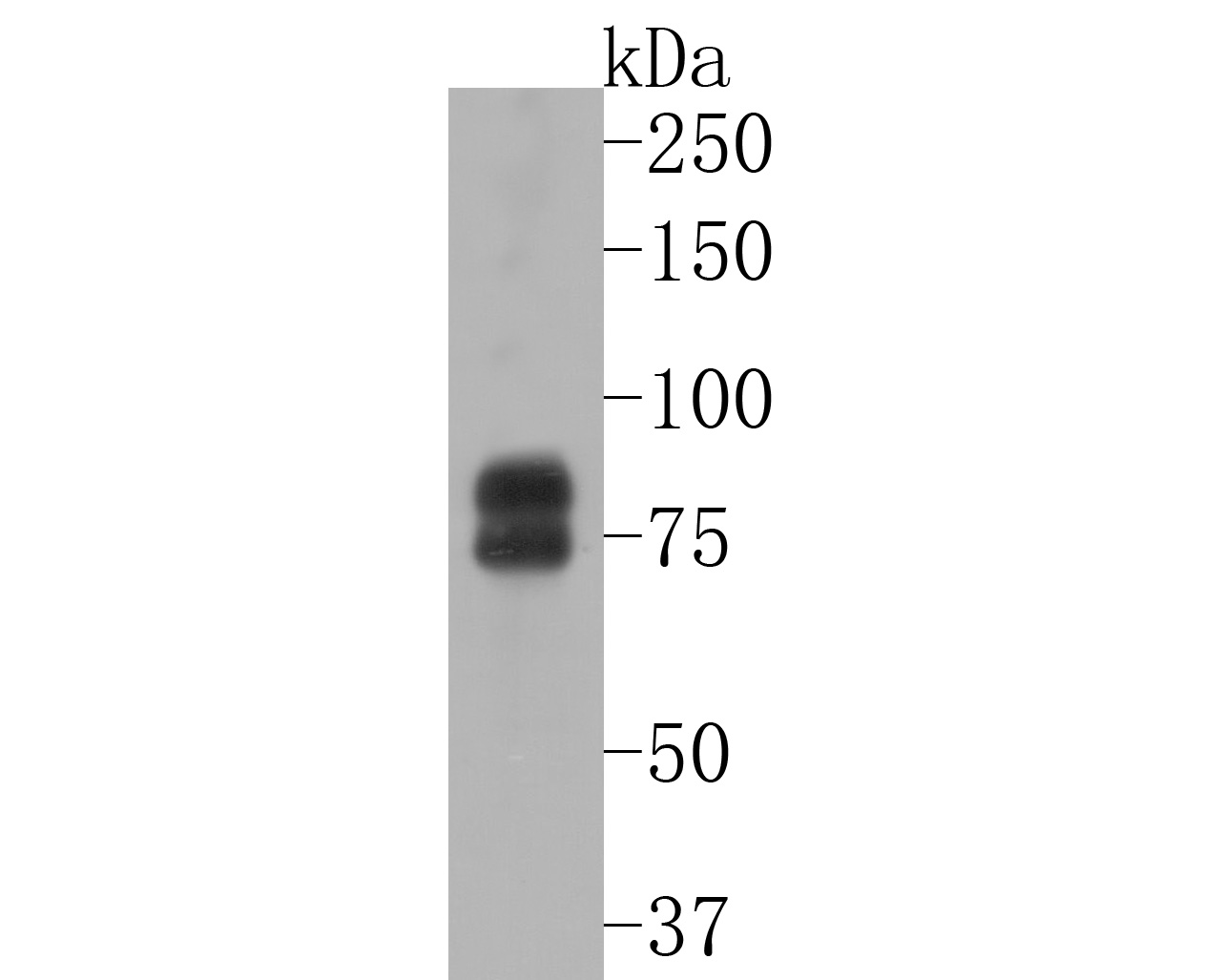 Western blot analysis of FMRP on Daudi cell lysates. Proteins were transferred to a PVDF membrane and blocked with 5% BSA in PBS for 1 hour at room temperature. The primary antibody (ET1703-70, 1/500) was used in 5% BSA at room temperature for 2 hours. Goat Anti-Rabbit IgG - HRP Secondary Antibody (HA1001) at 1:5,000 dilution was used for 1 hour at room temperature.