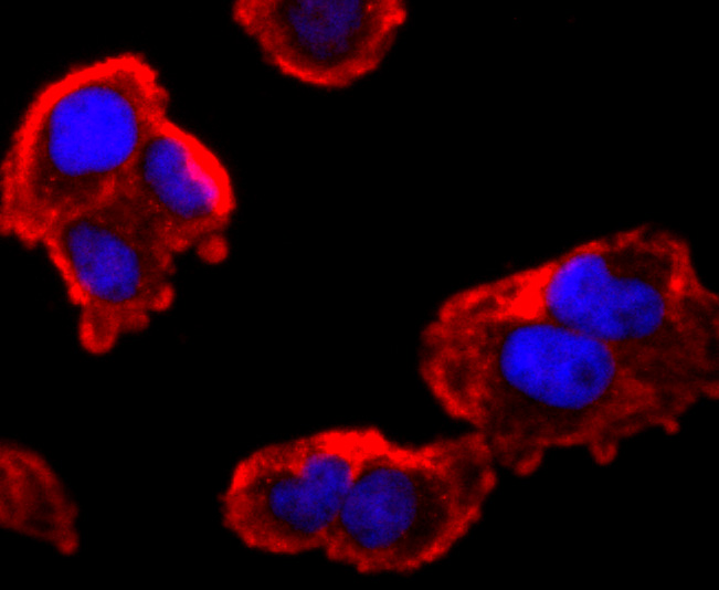 ICC staining of FMRP in Hela cells (red). Formalin fixed cells were permeabilized with 0.1% Triton X-100 in TBS for 10 minutes at room temperature and blocked with 1% Blocker BSA for 15 minutes at room temperature. Cells were probed with the primary antibody (ET1703-70, 1/100) for 1 hour at room temperature, washed with PBS. Alexa Fluor®594 Goat anti-Rabbit IgG was used as the secondary antibody at 1/1,000 dilution. The nuclear counter stain is DAPI (blue).