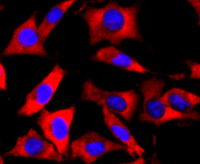 ICC staining of FMRP in SH-SY5Y cells (red). Formalin fixed cells were permeabilized with 0.1% Triton X-100 in TBS for 10 minutes at room temperature and blocked with 1% Blocker BSA for 15 minutes at room temperature. Cells were probed with the primary antibody (ET1703-70, 1/100) for 1 hour at room temperature, washed with PBS. Alexa Fluor®594 Goat anti-Rabbit IgG was used as the secondary antibody at 1/1,000 dilution. The nuclear counter stain is DAPI (blue).