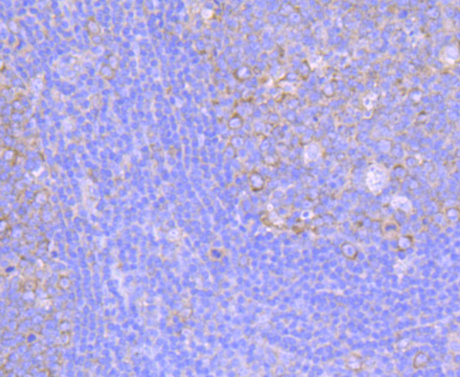 Immunohistochemical analysis of paraffin-embedded human tonsil tissue using anti-FMRP antibody. The section was pre-treated using heat mediated antigen retrieval with Tris-EDTA buffer (pH 8.0-8.4) for 20 minutes.The tissues were blocked in 5% BSA for 30 minutes at room temperature, washed with ddH2O and PBS, and then probed with the primary antibody (ET1703-70, 1/50) for 30 minutes at room temperature. The detection was performed using an HRP conjugated compact polymer system. DAB was used as the chromogen. Tissues were counterstained with hematoxylin and mounted with DPX.