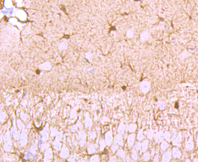 Immunohistochemical analysis of paraffin-embedded mouse brain tissue using anti-S100 alpha antibody. The section was pre-treated using heat mediated antigen retrieval with Tris-EDTA buffer (pH 8.0-8.4) for 20 minutes.The tissues were blocked in 5% BSA for 30 minutes at room temperature, washed with ddH2O and PBS, and then probed with the primary antibody (ET1703-72, 1/50) for 30 minutes at room temperature. The detection was performed using an HRP conjugated compact polymer system. DAB was used as the chromogen. Tissues were counterstained with hematoxylin and mounted with DPX.