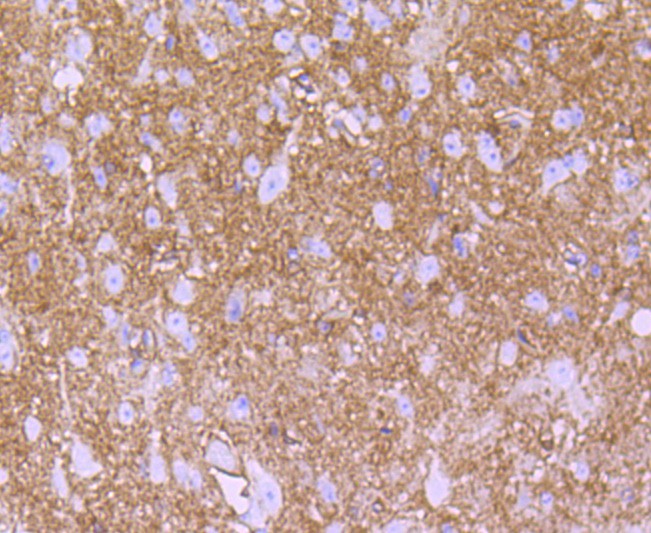 Immunohistochemical analysis of paraffin-embedded mouse spinal cord tissue using anti-S100 alpha antibody. The section was pre-treated using heat mediated antigen retrieval with Tris-EDTA buffer (pH 8.0-8.4) for 20 minutes.The tissues were blocked in 5% BSA for 30 minutes at room temperature, washed with ddH2O and PBS, and then probed with the primary antibody (ET1703-72, 1/50) for 30 minutes at room temperature. The detection was performed using an HRP conjugated compact polymer system. DAB was used as the chromogen. Tissues were counterstained with hematoxylin and mounted with DPX.