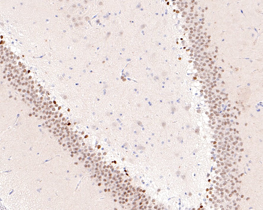 Immunohistochemical analysis of paraffin-embedded rat brain tissue with Rabbit anti-NeuroD1 antibody (ET1703-73) at 1/400 dilution.<br />
<br />
The section was pre-treated using heat mediated antigen retrieval with sodium citrate buffer (pH 6.0) for 2 minutes. The tissues were blocked in 1% BSA for 20 minutes at room temperature, washed with ddH2O and PBS, and then probed with the primary antibody (ET1703-73) at 1/400 dilution for 1 hour at room temperature. The detection was performed using an HRP conjugated compact polymer system. DAB was used as the chromogen. Tissues were counterstained with hematoxylin and mounted with DPX.