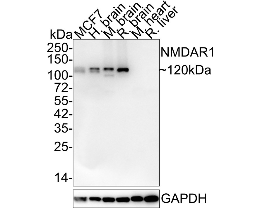 Western blot analysis of NMDAR1 on different lysates with Rabbit anti-NMDAR1 antibody (ET1703-75) at 1/5,000 dilution.<br />
<br />
Lane 1: MCF7 cell lysate (15 µg/Lane)<br />
Lane 2: Human brain tissue lysate (20 µg/Lane)<br />
Lane 3: Mouse brain tissue lysate (20 µg/Lane)<br />
Lane 4: Rat brain tissue lysate (20 µg/Lane)<br />
Lane 5: Mouse heart tissue lysate (negative) (20 µg/Lane)<br />
Lane 6: Rat liver tissue lysate (negative) (20 µg/Lane)<br />
<br />
Predicted band size: 105 kDa<br />
Observed band size: 120 kDa<br />
<br />
Exposure time: 1 minute 2 seconds;<br />
<br />
4-20% SDS-PAGE gel.<br />
<br />
Proteins were transferred to a PVDF membrane and blocked with 5% NFDM/TBST for 1 hour at room temperature. The primary antibody (ET1703-75) at 1/5,000 dilution was used in 5% NFDM/TBST at 4℃ overnight. Goat Anti-Rabbit IgG - HRP Secondary Antibody (HA1001) at 1/50,000 dilution was used for 1 hour at room temperature.