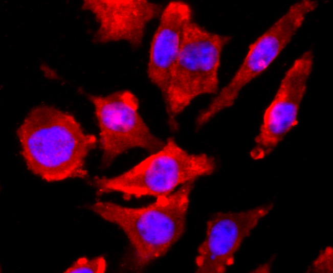 ICC staining of NMDAR1 in SH-SY5Y cells (red). Formalin fixed cells were permeabilized with 0.1% Triton X-100 in TBS for 10 minutes at room temperature and blocked with 1% Blocker BSA for 15 minutes at room temperature. Cells were probed with the primary antibody (ET1703-75, 1/50) for 1 hour at room temperature, washed with PBS. Alexa Fluor®594 Goat anti-Rabbit IgG was used as the secondary antibody at 1/1,000 dilution. The nuclear counter stain is DAPI (blue).