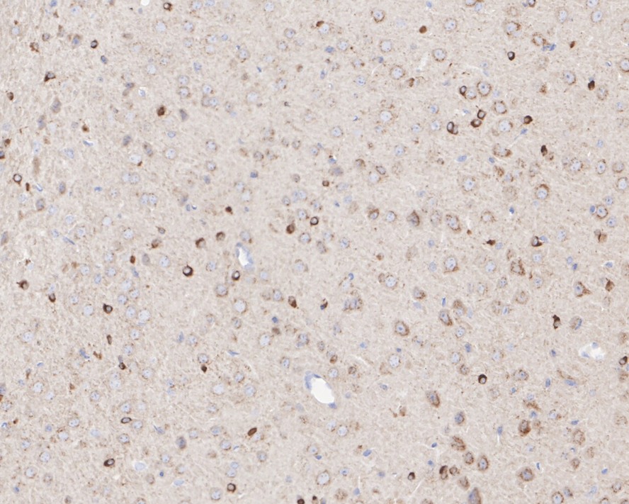 Immunohistochemical analysis of paraffin-embedded mouse brain tissue with Rabbit anti-NMDAR1 antibody (ET1703-75) at 1/800 dilution.<br />
<br />
The section was pre-treated using heat mediated antigen retrieval with Tris-EDTA buffer (pH 9.0) for 20 minutes. The tissues were blocked in 1% BSA for 20 minutes at room temperature, washed with ddH2O and PBS, and then probed with the primary antibody (ET1703-75) at 1/800 dilution for 1 hour at room temperature. The detection was performed using an HRP conjugated compact polymer system. DAB was used as the chromogen. Tissues were counterstained with hematoxylin and mounted with DPX.