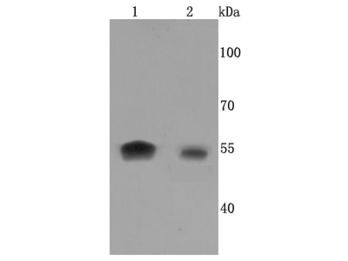 Western blot analysis of Aromatase on different cells lysates using anti-Aromatase antibody at 1/500 dilution.<br />
Positive control:<br />
Lane 1: JAR cell lysate<br />
Lane 2: Jurkat cell lysate