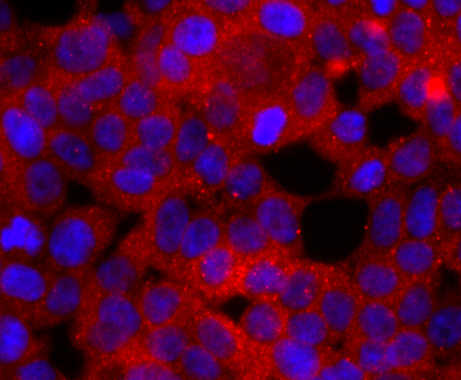 ICC staining of Rac1-2-3 in 293T cells (red). Formalin fixed cells were permeabilized with 0.1% Triton X-100 in TBS for 10 minutes at room temperature and blocked with 1% Blocker BSA for 15 minutes at room temperature. Cells were probed with the primary antibody (ET1703-80, 1/50) for 1 hour at room temperature, washed with PBS. Alexa Fluor®594 Goat anti-Rabbit IgG was used as the secondary antibody at 1/1,000 dilution. The nuclear counter stain is DAPI (blue).