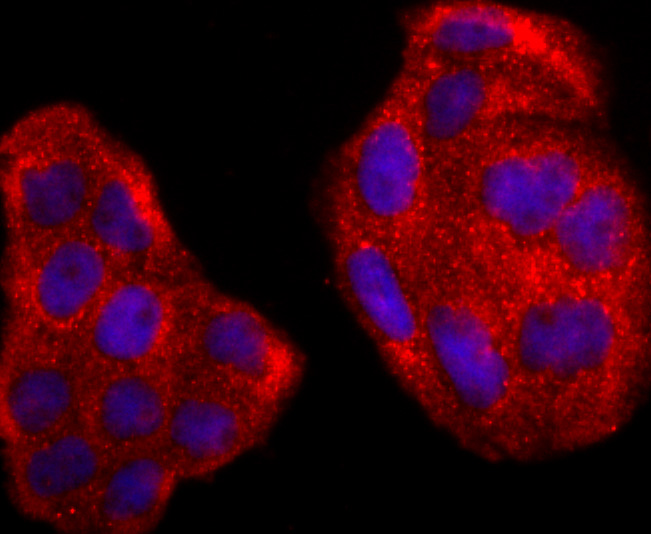 ICC staining of Rac1-2-3 in Hela cells (red). Formalin fixed cells were permeabilized with 0.1% Triton X-100 in TBS for 10 minutes at room temperature and blocked with 1% Blocker BSA for 15 minutes at room temperature. Cells were probed with the primary antibody (ET1703-80, 1/50) for 1 hour at room temperature, washed with PBS. Alexa Fluor®594 Goat anti-Rabbit IgG was used as the secondary antibody at 1/1,000 dilution. The nuclear counter stain is DAPI (blue).