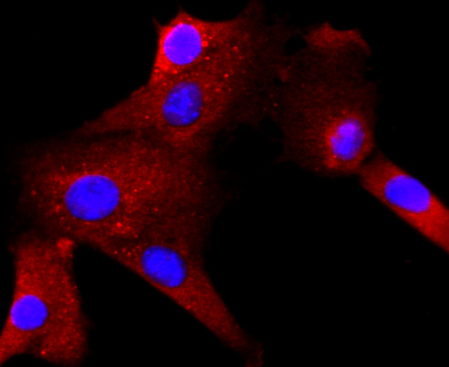 ICC staining of Rac1-2-3 in NIH/3T3 cells (red). Formalin fixed cells were permeabilized with 0.1% Triton X-100 in TBS for 10 minutes at room temperature and blocked with 1% Blocker BSA for 15 minutes at room temperature. Cells were probed with the primary antibody (ET1703-80, 1/50) for 1 hour at room temperature, washed with PBS. Alexa Fluor®594 Goat anti-Rabbit IgG was used as the secondary antibody at 1/1,000 dilution. The nuclear counter stain is DAPI (blue).