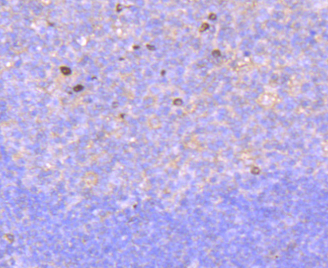 Immunohistochemical analysis of paraffin-embedded human tonsil tissue using anti-Rac1-2-3 antibody. The section was pre-treated using heat mediated antigen retrieval with Tris-EDTA buffer (pH 8.0-8.4) for 20 minutes.The tissues were blocked in 5% BSA for 30 minutes at room temperature, washed with ddH2O and PBS, and then probed with the primary antibody (ET1703-80, 1/50) for 30 minutes at room temperature. The detection was performed using an HRP conjugated compact polymer system. DAB was used as the chromogen. Tissues were counterstained with hematoxylin and mounted with DPX.