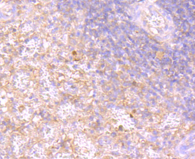 Immunohistochemical analysis of paraffin-embedded human spleen tissue using anti-Rac1-2-3 antibody. The section was pre-treated using heat mediated antigen retrieval with Tris-EDTA buffer (pH 8.0-8.4) for 20 minutes.The tissues were blocked in 5% BSA for 30 minutes at room temperature, washed with ddH2O and PBS, and then probed with the primary antibody (ET1703-80, 1/50) for 30 minutes at room temperature. The detection was performed using an HRP conjugated compact polymer system. DAB was used as the chromogen. Tissues were counterstained with hematoxylin and mounted with DPX.