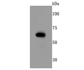 Western blot analysis of RPE65 on mouse eyeball tissue lysates. Proteins were transferred to a PVDF membrane and blocked with 5% BSA in PBS for 1 hour at room temperature. The primary antibody (ET1703-82, 1/500) was used in 5% BSA at room temperature for 2 hours. Goat Anti-Rabbit IgG - HRP Secondary Antibody (HA1001) at 1:200,000 dilution was used for 1 hour at room temperature.