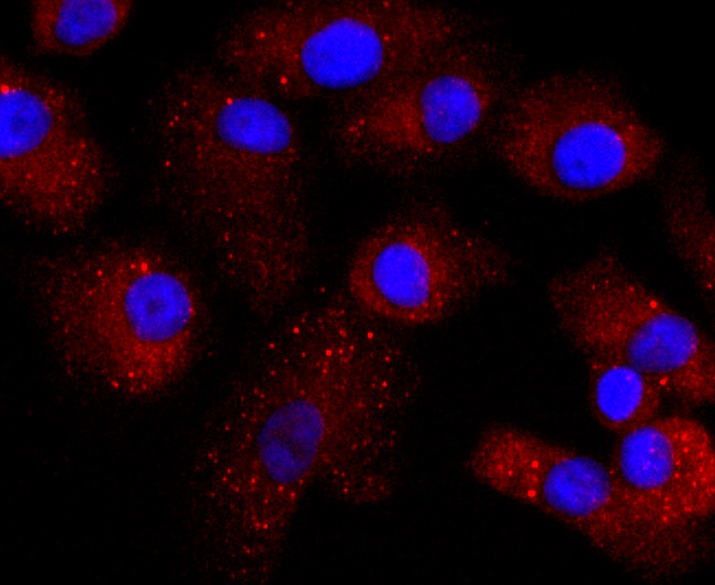 ICC staining of TTR in A549 cells (red). Formalin fixed cells were permeabilized with 0.1% Triton X-100 in TBS for 10 minutes at room temperature and blocked with 1% Blocker BSA for 15 minutes at room temperature. Cells were probed with the primary antibody (ET1703-83, 1/50) for 1 hour at room temperature, washed with PBS. Alexa Fluor®594 Goat anti-Rabbit IgG was used as the secondary antibody at 1/1,000 dilution. The nuclear counter stain is DAPI (blue).