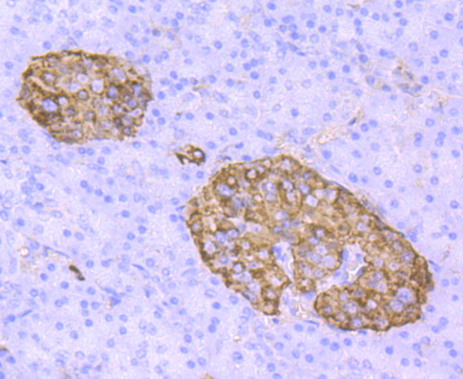 Immunohistochemical analysis of paraffin-embedded human pancreas tissue using anti-TTR antibody. The section was pre-treated using heat mediated antigen retrieval with Tris-EDTA buffer (pH 8.0-8.4) for 20 minutes.The tissues were blocked in 5% BSA for 30 minutes at room temperature, washed with ddH2O and PBS, and then probed with the primary antibody (ET1703-83, 1/50) for 30 minutes at room temperature. The detection was performed using an HRP conjugated compact polymer system. DAB was used as the chromogen. Tissues were counterstained with hematoxylin and mounted with DPX.