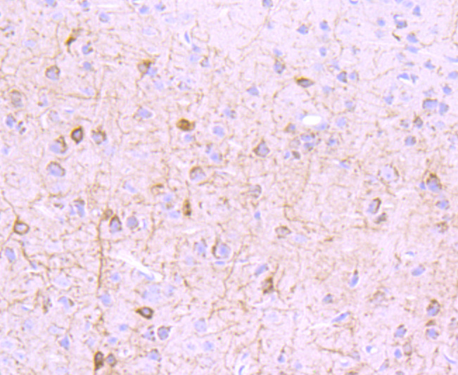 Immunohistochemical analysis of paraffin-embedded mouse brain tissue with Rabbit anti-mGluR1 antibody (ET1703-84) at 1/50 dilution.<br />
<br />
The section was pre-treated using heat mediated antigen retrieval with Tris-EDTA buffer (pH 9.0) for 20 minutes. The tissues were blocked in 1% BSA for 20 minutes at room temperature, washed with ddH2O and PBS, and then probed with the primary antibody (ET1703-84) at 1/50 dilution for 1 hour at room temperature. The detection was performed using an HRP conjugated compact polymer system. DAB was used as the chromogen. Tissues were counterstained with hematoxylin and mounted with DPX.