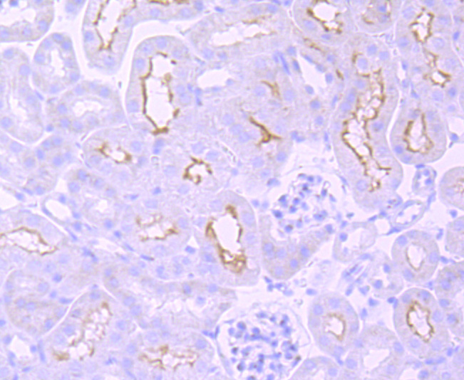 Immunohistochemical analysis of paraffin-embedded mouse kidney  tissue with Rabbit anti-mGluR1 antibody (ET1703-84) at 1/50 dilution.<br />
<br />
The section was pre-treated using heat mediated antigen retrieval with Tris-EDTA buffer (pH 9.0) for 20 minutes. The tissues were blocked in 1% BSA for 20 minutes at room temperature, washed with ddH2O and PBS, and then probed with the primary antibody (ET1703-84) at 1/50 dilution for 1 hour at room temperature. The detection was performed using an HRP conjugated compact polymer system. DAB was used as the chromogen. Tissues were counterstained with hematoxylin and mounted with DPX..
