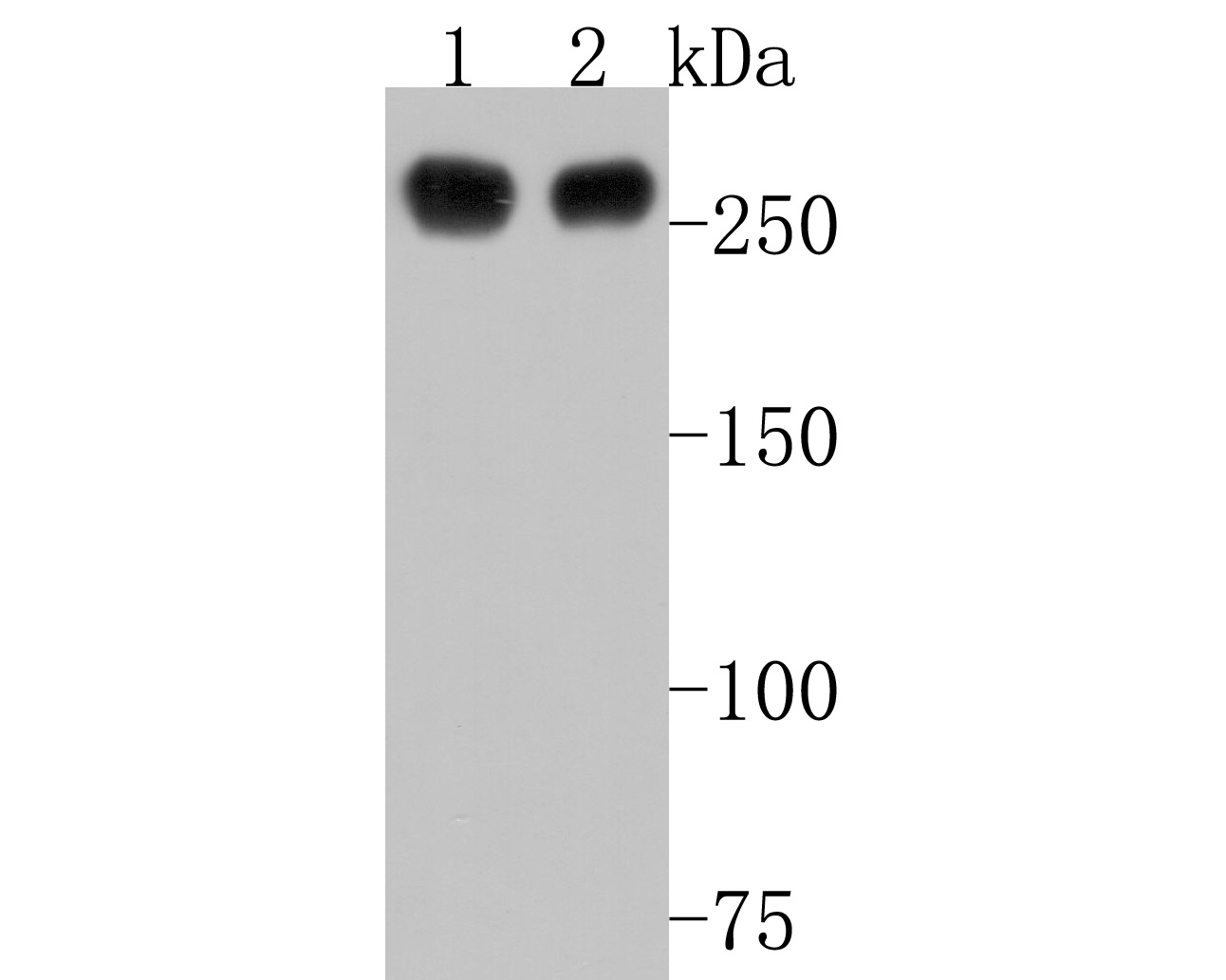 Western blot analysis of Phospho-POLR2A (S2) on different lysates. Proteins were transferred to a PVDF membrane and blocked with 5% BSA in PBS for 1 hour at room temperature. The primary antibody (ET1703-86, 1/500) was used in 5% BSA at room temperature for 2 hours. Goat Anti-Rabbit IgG - HRP Secondary Antibody (HA1001) at 1:200,000 dilution was used for 1 hour at room temperature.<br />
Positive control: <br />
Lane 1: Hela cell lysate<br />
Lane 2: MCF-7 cell lysate
