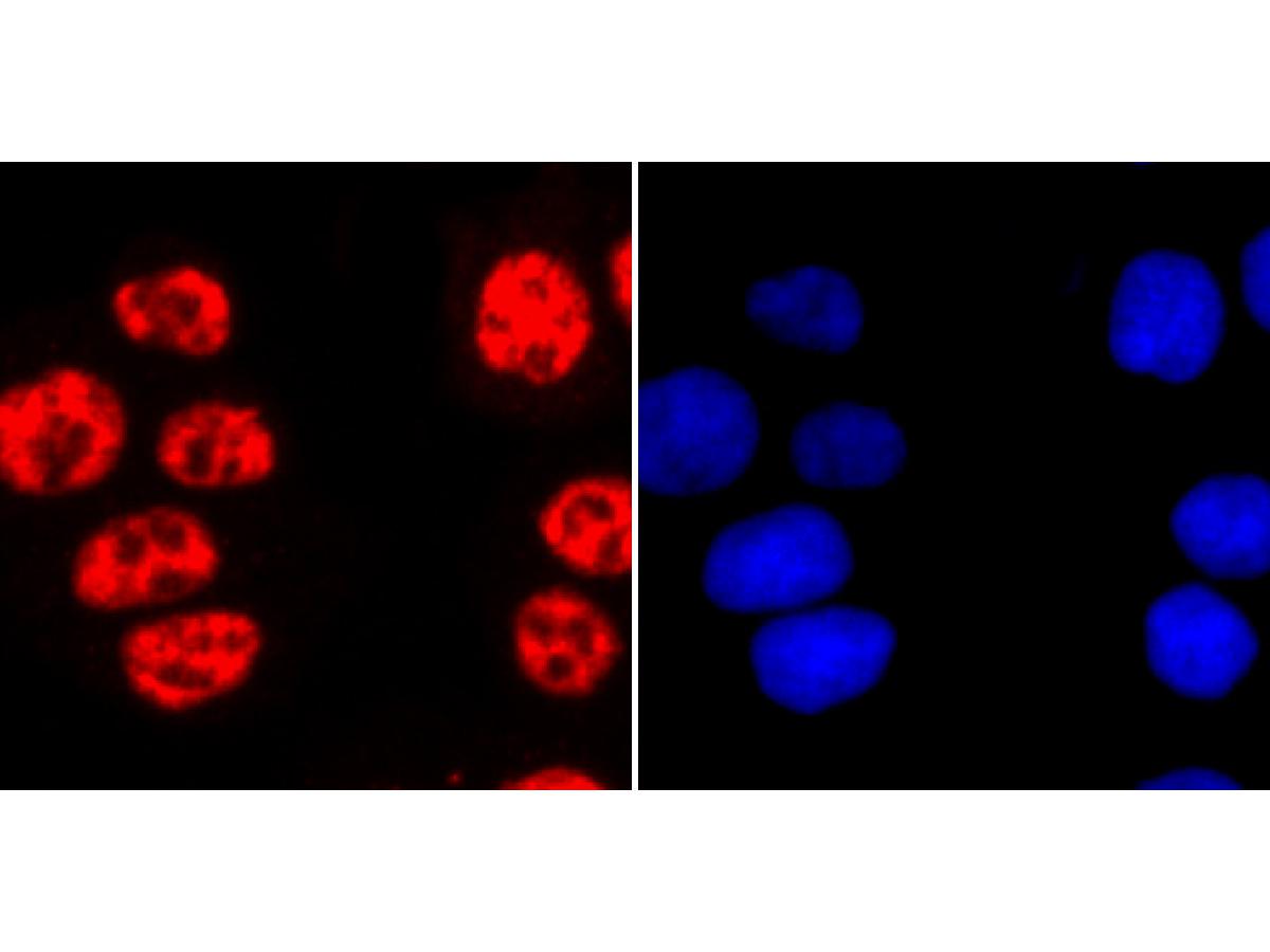 ICC staining of Phospho-POLR2A (S2) in Hela cells (red). Formalin fixed cells were permeabilized with 0.1% Triton X-100 in TBS for 10 minutes at room temperature and blocked with 10% negative goat serum for 15 minutes at room temperature. Cells were probed with the primary antibody (ET1703-86, 1/50) for 1 hour at room temperature, washed with PBS. Alexa Fluor®594 conjugate-Goat anti-Rabbit IgG was used as the secondary antibody at 1/1,000 dilution. The nuclear counter stain is DAPI (blue).