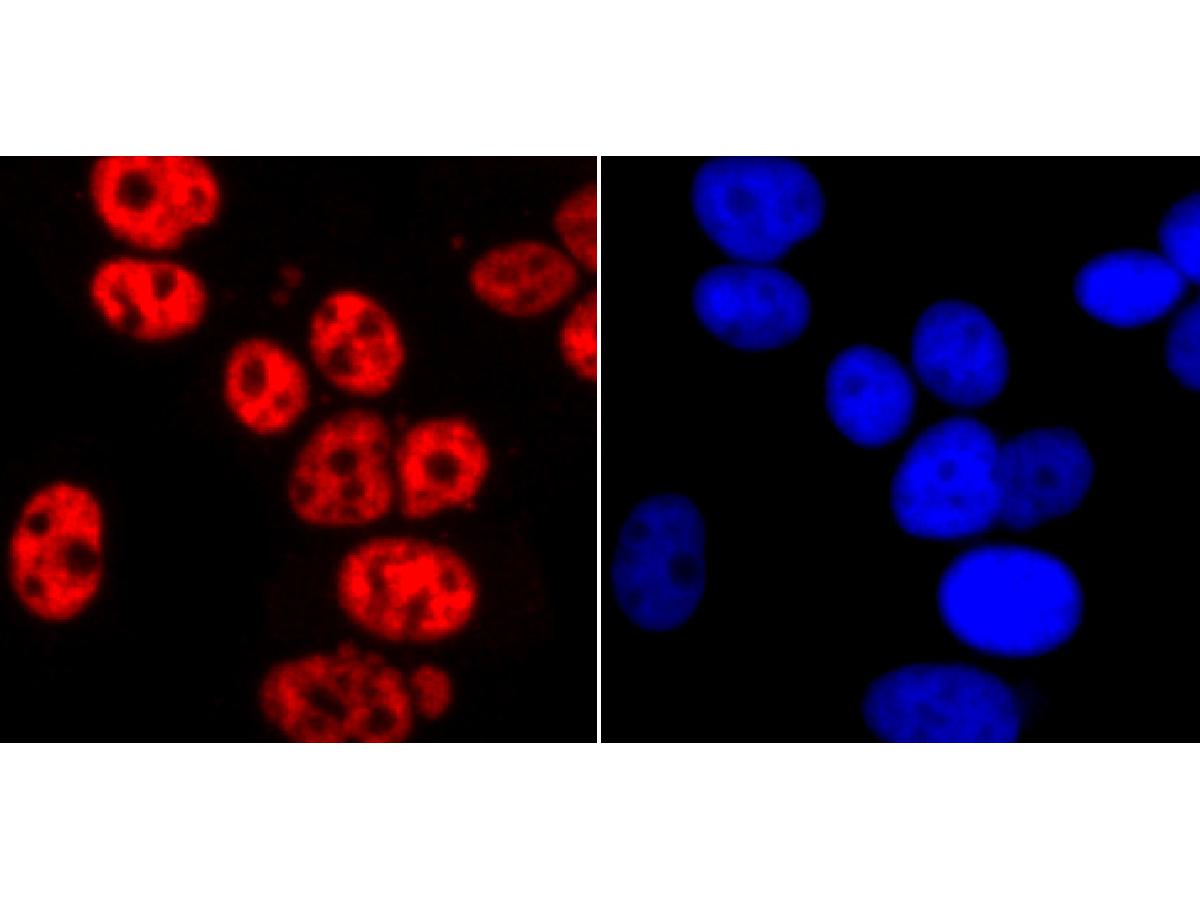 ICC staining of Phospho-POLR2A (S2) in MCF-7 cells (red). Formalin fixed cells were permeabilized with 0.1% Triton X-100 in TBS for 10 minutes at room temperature and blocked with 10% negative goat serum for 15 minutes at room temperature. Cells were probed with the primary antibody (ET1703-86, 1/50) for 1 hour at room temperature, washed with PBS. Alexa Fluor®594 conjugate-Goat anti-Rabbit IgG was used as the secondary antibody at 1/1,000 dilution. The nuclear counter stain is DAPI (blue).