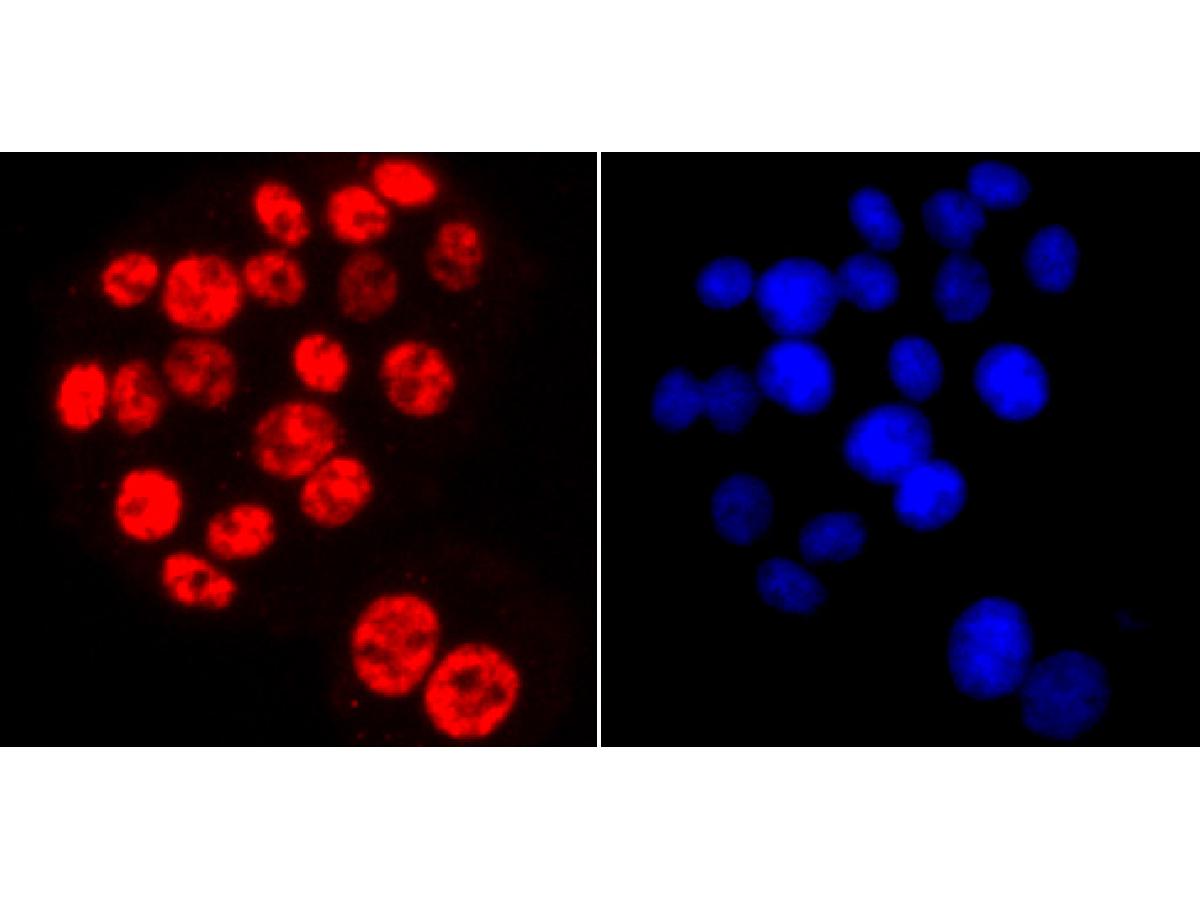 ICC staining of Phospho-POLR2A (S2) in PC-12 cells (red). Formalin fixed cells were permeabilized with 0.1% Triton X-100 in TBS for 10 minutes at room temperature and blocked with 10% negative goat serum for 15 minutes at room temperature. Cells were probed with the primary antibody (ET1703-86, 1/50) for 1 hour at room temperature, washed with PBS. Alexa Fluor®594 conjugate-Goat anti-Rabbit IgG was used as the secondary antibody at 1/1,000 dilution. The nuclear counter stain is DAPI (blue).