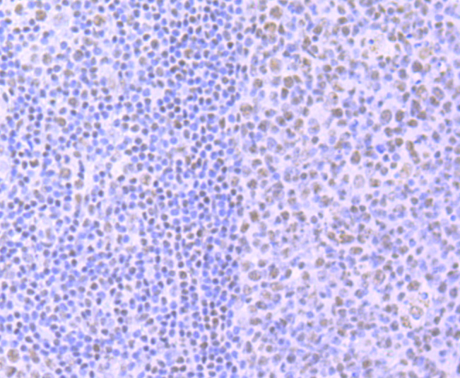 Immunohistochemical analysis of paraffin-embedded human tonsil tissue using anti-Phospho-POLR2A (S2) antibody. The section was pre-treated using heat mediated antigen retrieval with sodium citrate buffer (pH 6.0) for 20 minutes. The tissues were blocked in 1% BSA for 30 minutes at room temperature, washed with ddH2O and PBS, and then probed with the primary antibody (ET1703-86, 1/50)  for 30 minutes at room temperature. The detection was performed using an HRP conjugated compact polymer system. DAB was used as the chromogen. Tissues were counterstained with hematoxylin and mounted with DPX.