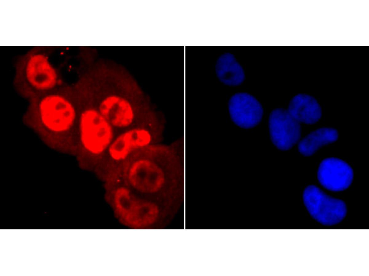 ICC staining of Phospho-POLR2A (S5) in MCF-7 cells (red). Formalin fixed cells were permeabilized with 0.1% Triton X-100 in TBS for 10 minutes at room temperature and blocked with 10% negative goat serum for 15 minutes at room temperature. Cells were probed with the primary antibody (ET1703-87, 1/50) for 1 hour at room temperature, washed with PBS. Alexa Fluor®594 Goat anti-Rabbit IgG was used as the secondary antibody at 1/1,000 dilution. The nuclear counter stain is DAPI (blue).