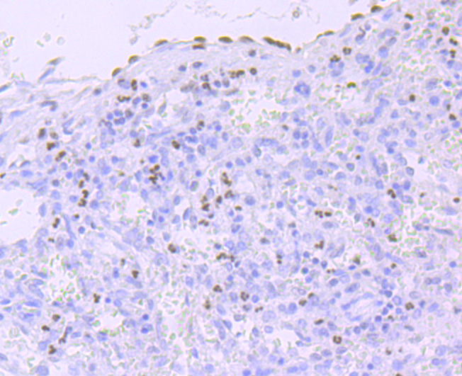 Immunohistochemical analysis of paraffin-embedded human spleen tissue using anti-Phospho-POLR2A (S5) antibody. The section was pre-treated using heat mediated antigen retrieval with sodium citrate buffer (pH 6.0) for 20 minutes. The tissues were blocked in 1% BSA for 30 minutes at room temperature, washed with ddH2O and PBS, and then probed with the primary antibody (ET1703-87, 1/50)  for 30 minutes at room temperature. The detection was performed using an HRP conjugated compact polymer system. DAB was used as the chromogen. Tissues were counterstained with hematoxylin and mounted with DPX.