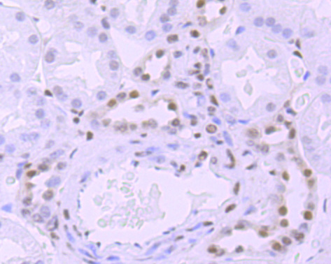 Immunohistochemical analysis of paraffin-embedded human kidney tissue using anti-Phospho-POLR2A (S5) antibody. The section was pre-treated using heat mediated antigen retrieval with sodium citrate buffer (pH 6.0) for 20 minutes. The tissues were blocked in 1% BSA for 30 minutes at room temperature, washed with ddH2O and PBS, and then probed with the primary antibody (ET1703-87, 1/50)  for 30 minutes at room temperature. The detection was performed using an HRP conjugated compact polymer system. DAB was used as the chromogen. Tissues were counterstained with hematoxylin and mounted with DPX.