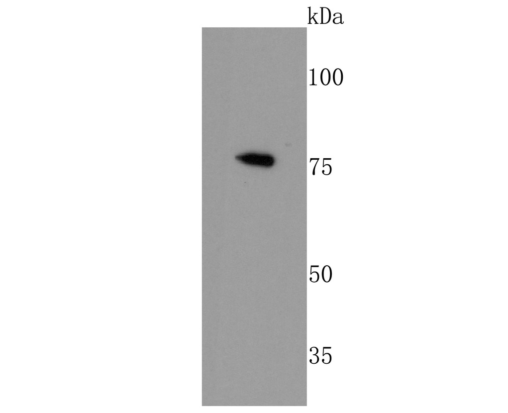 Western blot analysis of CTCF on zebrafish tissue lysates. Proteins were transferred to a PVDF membrane and blocked with 5% BSA in PBS for 1 hour at room temperature. The primary antibody (ET1703-90, 1/500) was used in 5% BSA at room temperature for 2 hours. Goat Anti-Rabbit IgG - HRP Secondary Antibody (HA1001) at 1:5,000 dilution was used for 1 hour at room temperature.