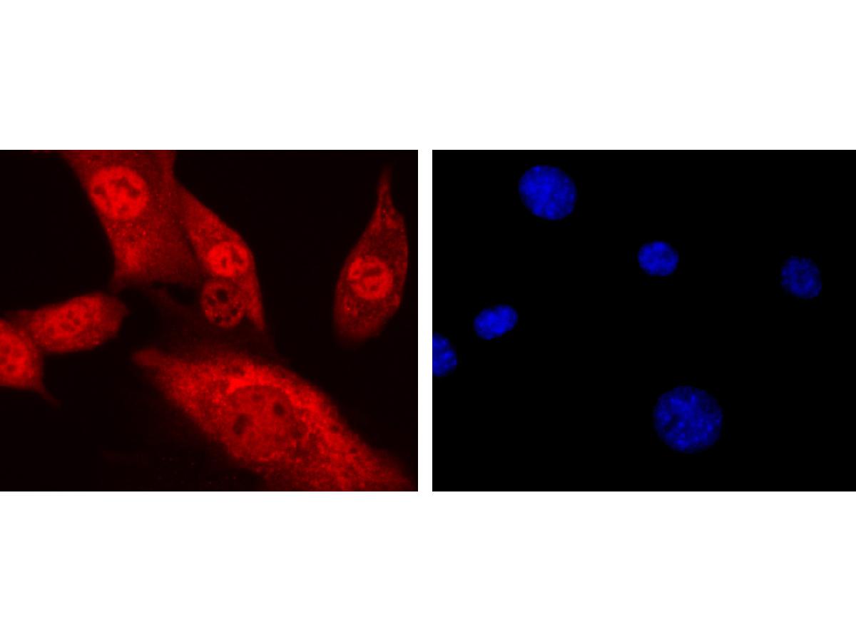 ICC staining of CTCF in NIH/3T3 cells (red). Formalin fixed cells were permeabilized with 0.1% Triton X-100 in TBS for 10 minutes at room temperature and blocked with 1% Blocker BSA for 15 minutes at room temperature. Cells were probed with the primary antibody (ET1703-90, 1/50) for 1 hour at room temperature, washed with PBS. Alexa Fluor®594 Goat anti-Rabbit IgG was used as the secondary antibody at 1/1,000 dilution. The nuclear counter stain is DAPI (blue).