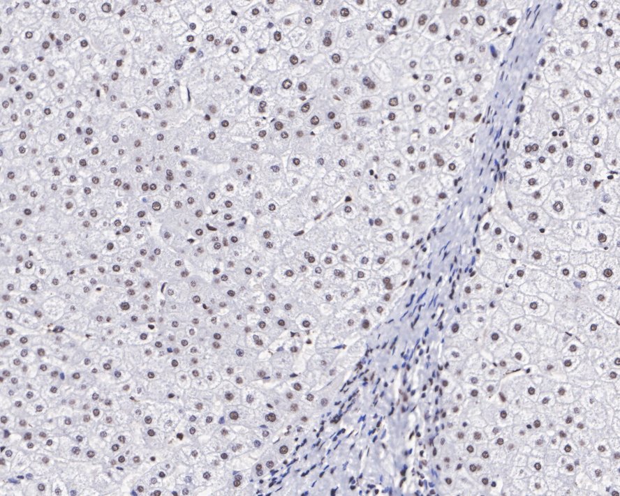 Immunohistochemical analysis of paraffin-embedded human liver tissue using anti-CTCF antibody. The section was pre-treated using heat mediated antigen retrieval with Tris-EDTA buffer (pH 8.0-8.4) for 20 minutes.The tissues were blocked in 5% BSA for 30 minutes at room temperature, washed with ddH2O and PBS, and then probed with the primary antibody (ET1703-90, 1/50) for 30 minutes at room temperature. The detection was performed using an HRP conjugated compact polymer system. DAB was used as the chromogen. Tissues were counterstained with hematoxylin and mounted with DPX.