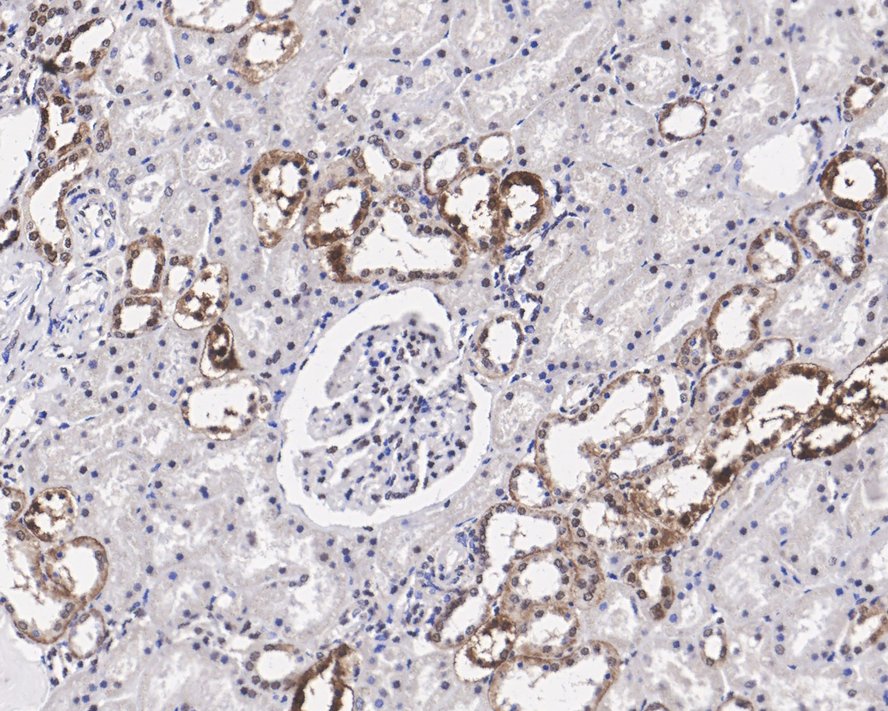Immunohistochemical analysis of paraffin-embedded human kidney tissue using anti-CTCF antibody. The section was pre-treated using heat mediated antigen retrieval with Tris-EDTA buffer (pH 8.0-8.4) for 20 minutes.The tissues were blocked in 5% BSA for 30 minutes at room temperature, washed with ddH2O and PBS, and then probed with the primary antibody (ET1703-90, 1/50) for 30 minutes at room temperature. The detection was performed using an HRP conjugated compact polymer system. DAB was used as the chromogen. Tissues were counterstained with hematoxylin and mounted with DPX.