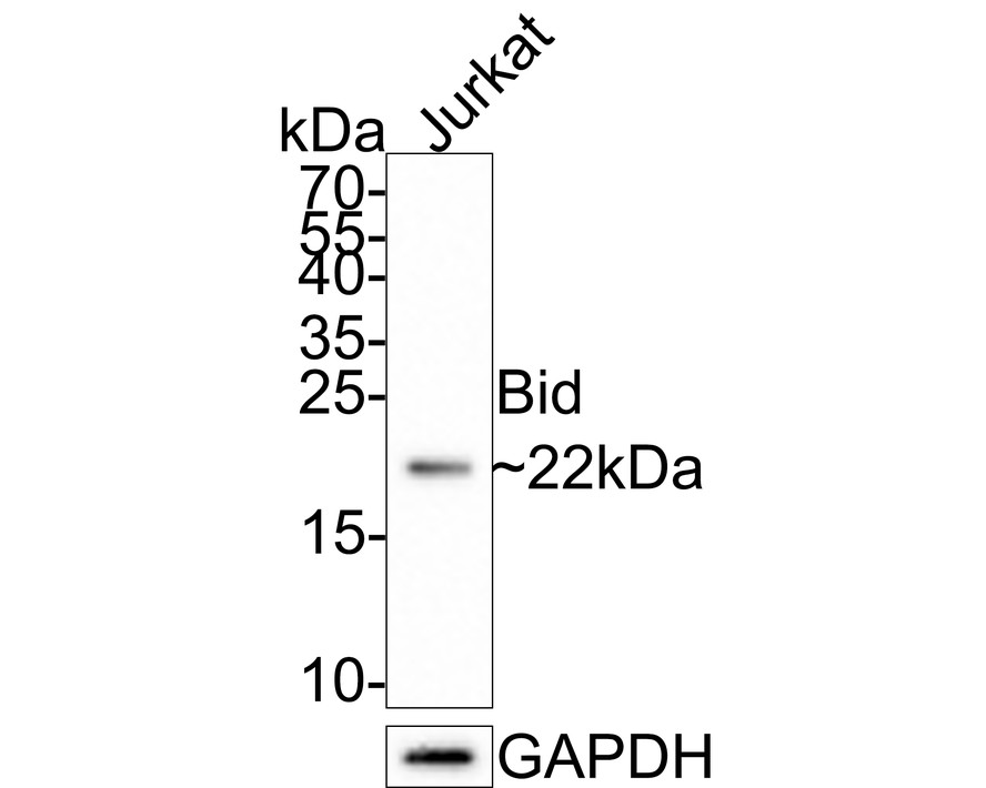 Western blot analysis of Bid on human thymus cells lysates with Rabbit anti-Bid antibody (ET1703-92) at 1/500 dilution.<br />
<br />
Lysates/proteins at 10 µg/Lane.<br />
<br />
Predicted band size: 22 kDa<br />
Observed band size: 22 kDa<br />
<br />
Proteins were transferred to a PVDF membrane and blocked with 5% NFDM/TBST for 1 hour at room temperature. The primary antibody (ET1703-92) at 1/500 dilution was used in 5% NFDM/TBST at room temperature for 2 hours. Goat Anti-Rabbit IgG - HRP Secondary Antibody (HA1001) at 1:300,000 dilution was used for 1 hour at room temperature
