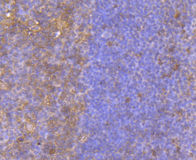 Immunohistochemical analysis of paraffin-embedded human tonsil tissue with Rabbit anti-Bid antibody (ET1703-92) at 1/50 dilution.Hela cells<br />
The section was pre-treated using heat mediated antigen retrieval with Tris-EDTA buffer (pH 9.0) for 20 minutes. The tissues were blocked in 1% BSA for 20 minutes at room temperature, washed with ddH2O and PBS, and then probed with the primary antibody (ET1703-92) at 1/50 dilution for 1 hour at room temperature. The detection was performed using an HRP conjugated compact polymer system. DAB was used as the chromogen. Tissues were counterstained with hematoxylin and mounted with DPX.