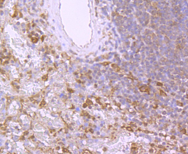 Immunohistochemical analysis of paraffin-embedded human spleen tissue with Rabbit anti-Bid antibody (ET1703-92) at 1/50 dilution.Hela cells<br />
The section was pre-treated using heat mediated antigen retrieval with Tris-EDTA buffer (pH 9.0) for 20 minutes. The tissues were blocked in 1% BSA for 20 minutes at room temperature, washed with ddH2O and PBS, and then probed with the primary antibody (ET1703-92) at 1/50 dilution for 1 hour at room temperature. The detection was performed using an HRP conjugated compact polymer system. DAB was used as the chromogen. Tissues were counterstained with hematoxylin and mounted with DPX.