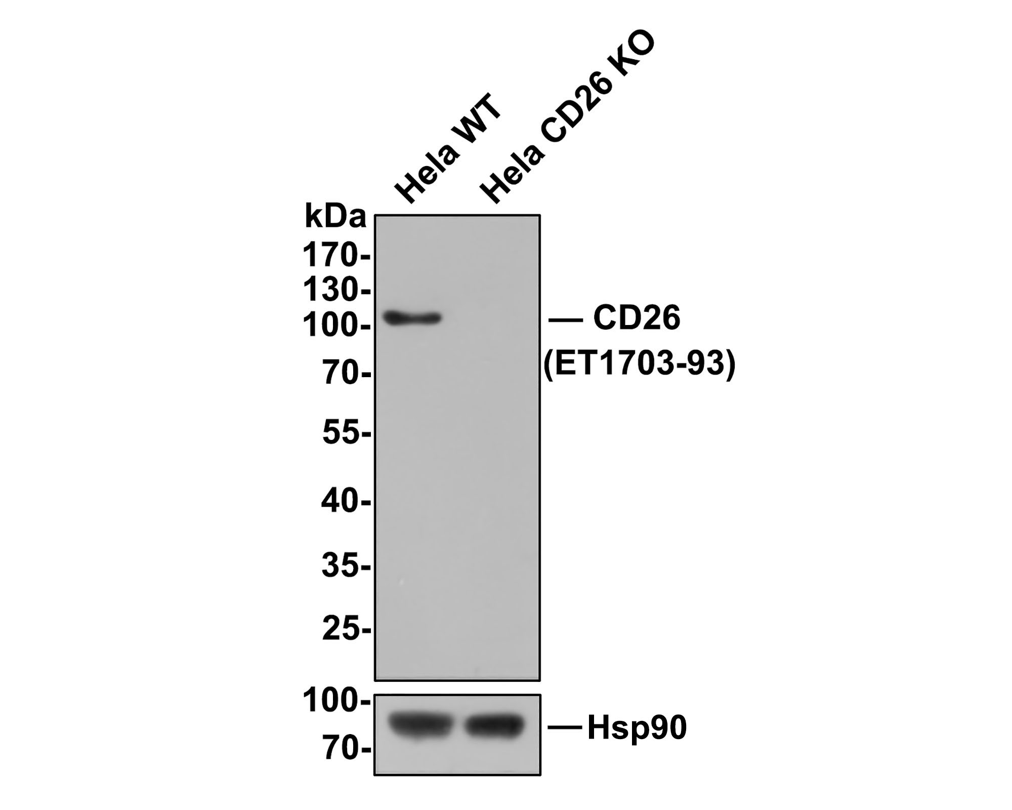All lanes: Western blot analysis of CD26 with anti-CD26 antibody (ET1703-93) at 1:500 dilution.<br />
Lane 1: Wild-type Hela whole cell lysate (10 µg).<br />
Lane 2: CD26 knockout Hela whole cell lysate (10 µg).<br />
<br />
ET1703-93 was shown to specifically react with CD26 in wild-type Hela cells. NO band was observed when CD26 knockout sample was tested. Wild-type and CD26 knockout samples were subjected to SDS-PAGE. Proteins were transferred to a PVDF membrane and blocked with 5% NFDM in TBST for 1 hour at room temperature. The primary antibody (ET1703-93, 1:500) was used in 5% BSA at room temperature for 2 hours. Goat Anti-Rabbit IgG-HRP Secondary Antibody (HA1001) at 1:300,000 dilution was used for 1 hour at room temperature.