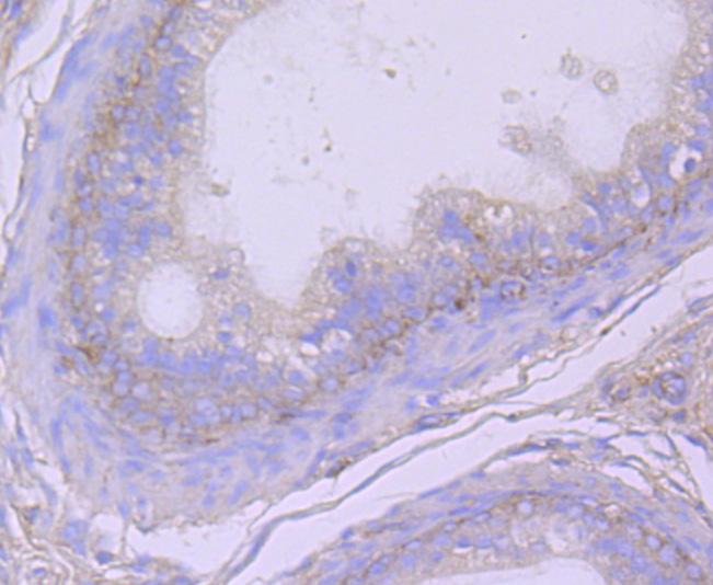 CD26 Recombinant Rabbit monoclonal Antibody