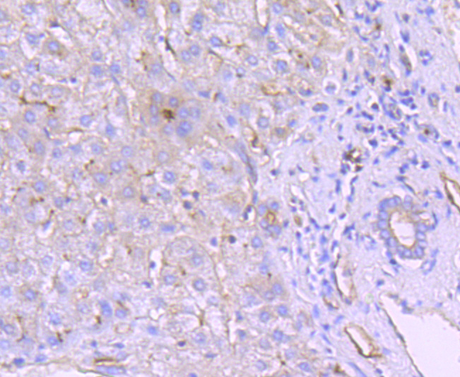 Immunohistochemical analysis of paraffin-embedded human liver tissue using anti-CD26 antibody. The section was pre-treated using heat mediated antigen retrieval with Tris-EDTA buffer (pH 8.0-8.4) for 20 minutes.The tissues were blocked in 5% BSA for 30 minutes at room temperature, washed with ddH2O and PBS, and then probed with the primary antibody (ET1703-93, 1/50) for 30 minutes at room temperature. The detection was performed using an HRP conjugated compact polymer system. DAB was used as the chromogen. Tissues were counterstained with hematoxylin and mounted with DPX.