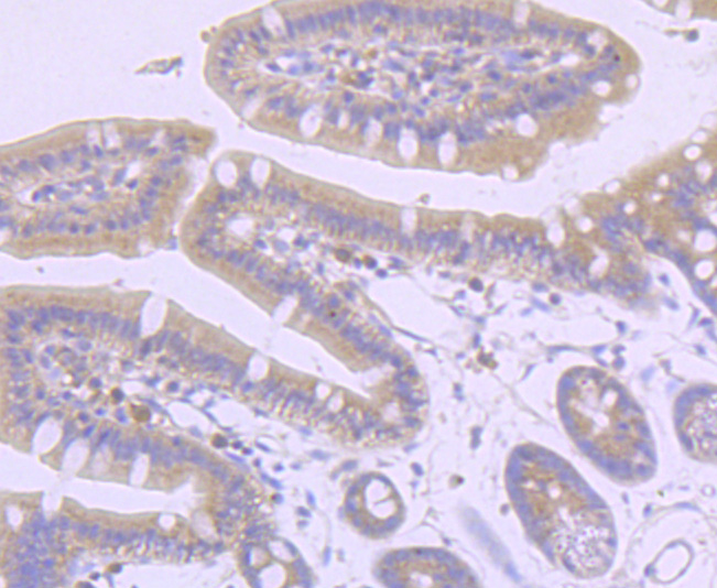 Immunohistochemical analysis of paraffin-embedded mouse colon tissue using anti-Axin2 antibody. The section was pre-treated using heat mediated antigen retrieval with Tris-EDTA buffer (pH 8.0-8.4) for 20 minutes.The tissues were blocked in 5% BSA for 30 minutes at room temperature, washed with ddH2O and PBS, and then probed with the primary antibody (ET1703-96, 1/50) for 30 minutes at room temperature. The detection was performed using an HRP conjugated compact polymer system. DAB was used as the chromogen. Tissues were counterstained with hematoxylin and mounted with DPX.