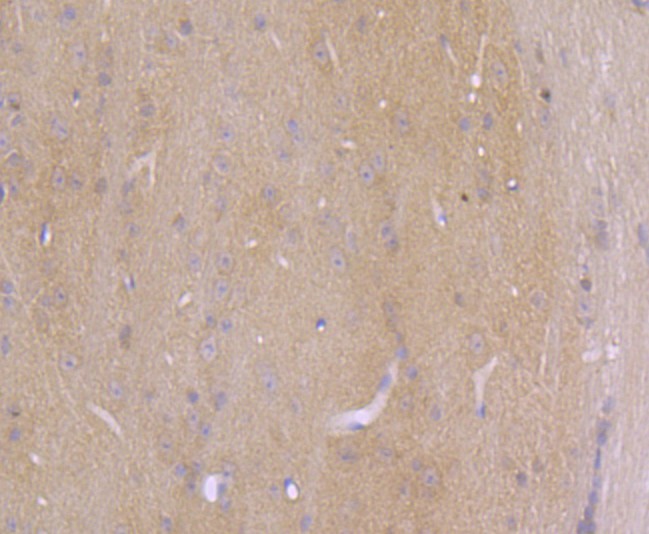 Immunohistochemical analysis of paraffin-embedded mouse brain tissue using anti-Axin2 antibody. The section was pre-treated using heat mediated antigen retrieval with Tris-EDTA buffer (pH 8.0-8.4) for 20 minutes.The tissues were blocked in 5% BSA for 30 minutes at room temperature, washed with ddH2O and PBS, and then probed with the primary antibody (ET1703-96, 1/50) for 30 minutes at room temperature. The detection was performed using an HRP conjugated compact polymer system. DAB was used as the chromogen. Tissues were counterstained with hematoxylin and mounted with DPX.