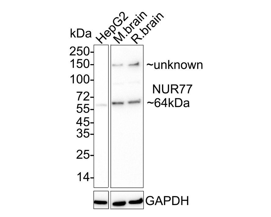 Western blot analysis of NUR77 on rat brain tissue lysates with Rabbit anti-NUR77 antibody (ET1703-97) at 1/500 dilution.<br />
<br />
Lysates/proteins at 20 µg/Lane.<br />
<br />
Predicted band size: 64 kDa<br />
Observed band size: 64 kDa<br />
<br />
Exposure time: 2 minutes;<br />
<br />
10% SDS-PAGE gel.<br />
<br />
Proteins were transferred to a PVDF membrane and blocked with 5% NFDM/TBST for 1 hour at room temperature. The primary antibody (ET1703-97) at 1/500 dilution was used in 5% NFDM/TBST at room temperature for 2 hours. Goat Anti-Rabbit IgG - HRP Secondary Antibody (HA1001) at 1:300,000 dilution was used for 1 hour at room temperature.
