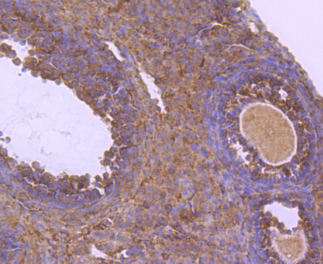 ICC staining of NUR77 in HepG2 cells (green). Formalin fixed cells were permeabilized with 0.1% Triton X-100 in TBS for 10 minutes at room temperature and blocked with 1% Blocker BSA for 15 minutes at room temperature. Cells were probed with the primary antibody (ET1703-97, 1/50) for 1 hour at room temperature, washed with PBS. Alexa Fluor®488 Goat anti-Rabbit IgG was used as the secondary antibody at 1/1,000 dilution. The nuclear counter stain is DAPI (blue).