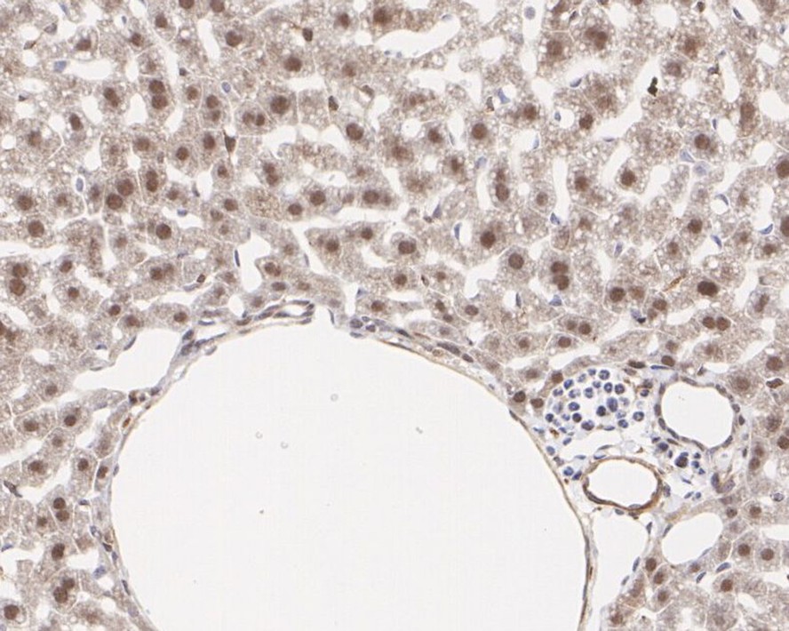 Immunohistochemical analysis of paraffin-embedded human liver tissue using anti-NUR77 antibody. The section was pre-treated using heat mediated antigen retrieval with Tris-EDTA buffer (pH 8.0-8.4) for 20 minutes.The tissues were blocked in 5% BSA for 30 minutes at room temperature, washed with ddH2O and PBS, and then probed with the primary antibody (ET1703-97, 1/50) for 30 minutes at room temperature. The detection was performed using an HRP conjugated compact polymer system. DAB was used as the chromogen. Tissues were counterstained with hematoxylin and mounted with DPX.