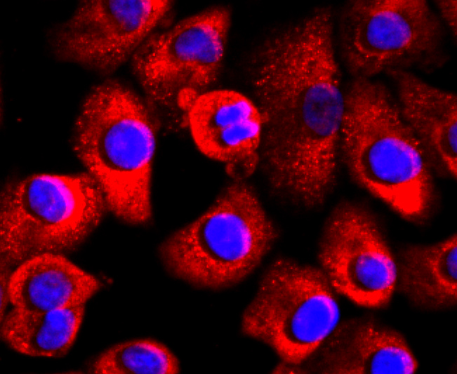 ICC staining of FABP4 in PMVEC cells (red). Formalin fixed cells were permeabilized with 0.1% Triton X-100 in TBS for 10 minutes at room temperature and blocked with 10% negative goat serum for 15 minutes at room temperature. Cells were probed with the primary antibody (ET1703-98, 1/50) for 1 hour at room temperature, washed with PBS. Alexa Fluor®594 conjugate-Goat anti-Rabbit IgG was used as the secondary antibody at 1/1,000 dilution. The nuclear counter stain is DAPI (blue).